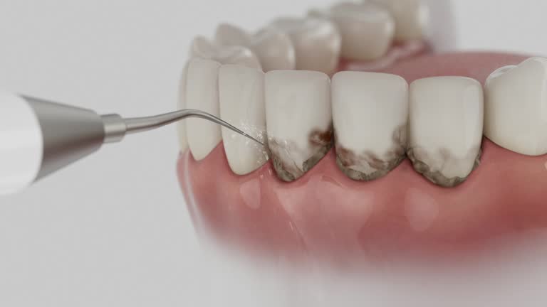 Trusted Invisalign Clear Aligners service in Council Bluffs, IA - Dentist Open Now